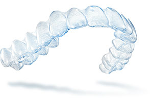 Invisalign removable clear aligners