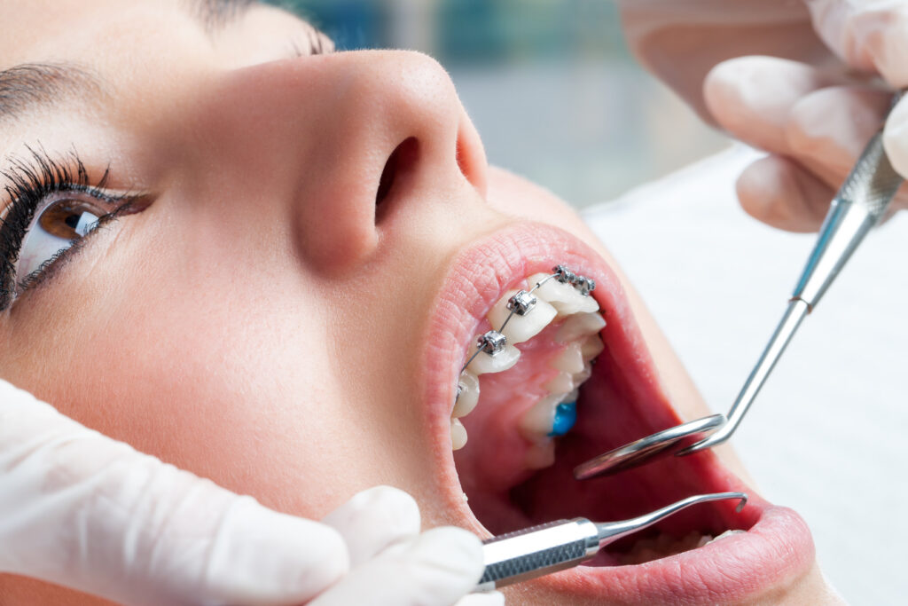Orthodontics Orange County, CA