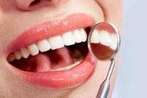 orthodontics in Rancho Mission Viejo, CA