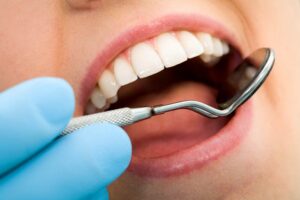invisalign in Laguna Niguel, CA