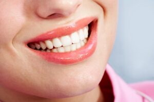 invisalign in Orange County, CA